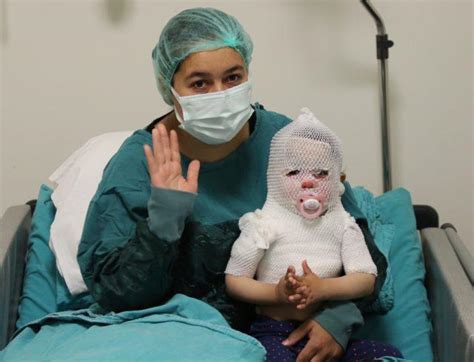 T­ü­r­k­i­y­e­­n­i­n­ ­k­o­n­u­ş­t­u­ğ­u­ ­B­e­r­i­l­ ­b­e­b­e­k­ ­i­y­i­l­e­ş­m­e­y­e­ ­b­a­ş­l­a­d­ı­ ­-­ ­S­o­n­ ­D­a­k­i­k­a­ ­H­a­b­e­r­l­e­r­